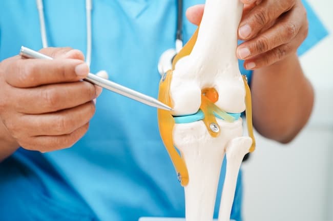 Arthritis